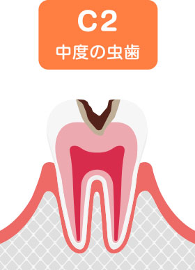 C2（中期）